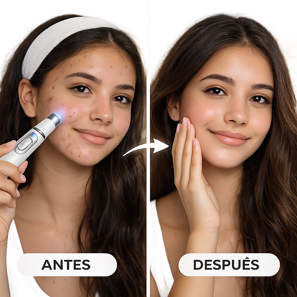 Bolígrafo Antiacné LED